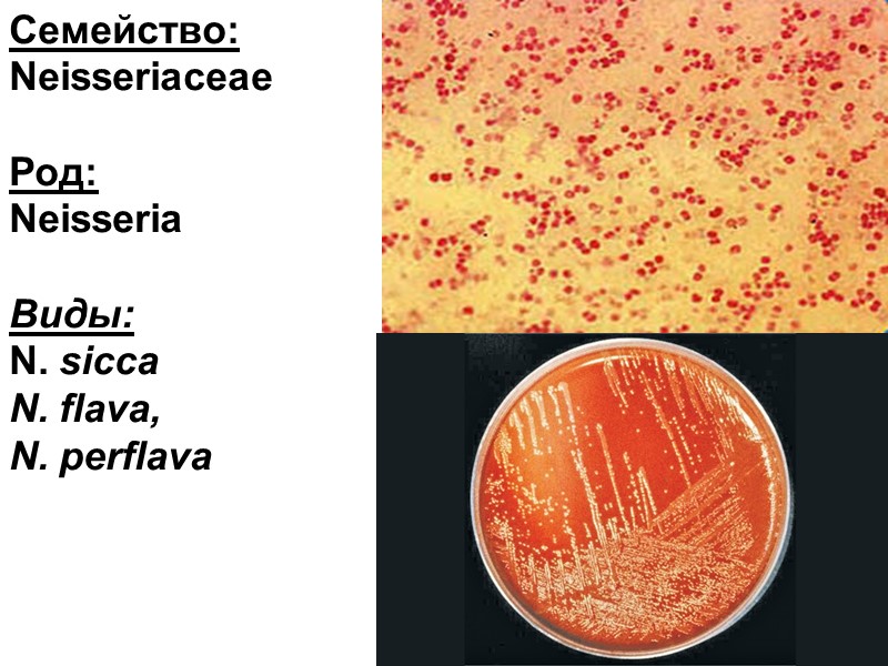 Семейство: Neisseriaceae  Род:  Neisseria  Виды: N. sicca N. flava,  N.